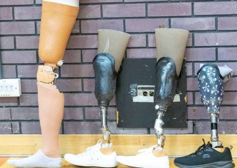Osobe s amputacijom traže od HZZO-a podizanje standarda za proteze i kolica