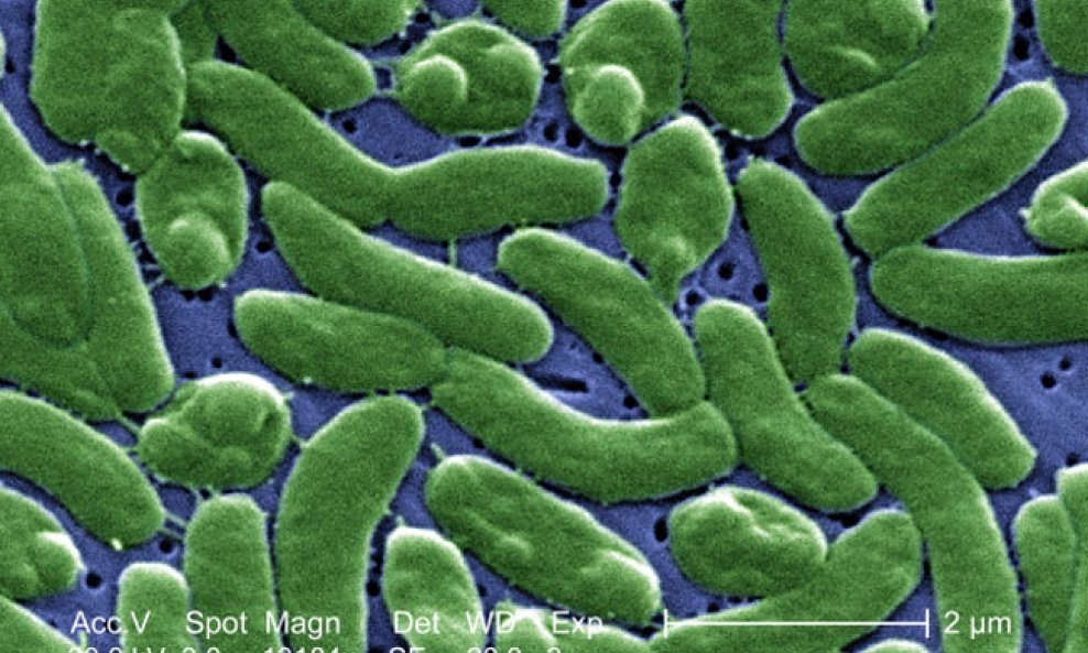 Vibrio vulnificus bakterija